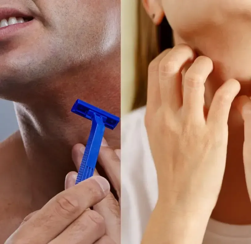 Cuidados antes e depois da depilação a laser
